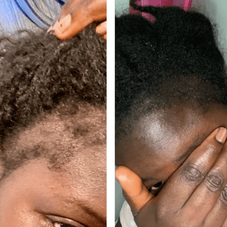 Mega Ayurvedic Hair Oil