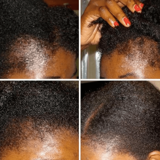 Mega Ayurvedic Hair Oil